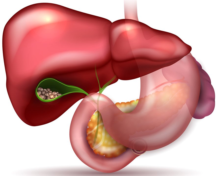 Gall Bladder Stone Surgery in Whitefield